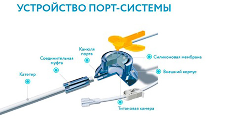 Устройство порт-системы